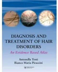 Diagnosis and Treatment of Hair Disorders: An Evidence-Based Atlas [Repost]