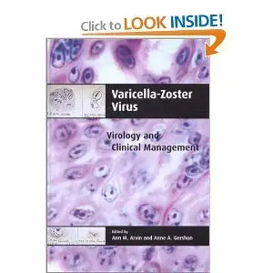 Varicella-Zoster Virus: Virology and Clinical Management