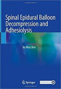 Spinal Epidural Balloon Decompression and Adhesiolysis