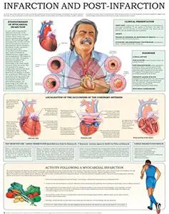 Infarction and Post Infarction e-chart: Quick reference guide