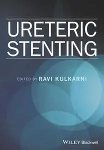 Ureteric Stenting