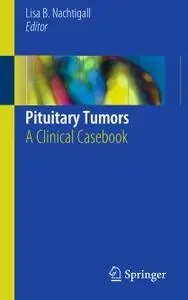 Pituitary Tumors: A Clinical Casebook (Repost)