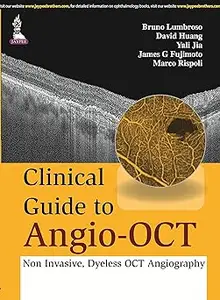 Clinical Guide to Angio-OCT: Non Invasive, Dyeless OCT Angiography