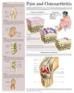 Pain and Osteoarthritis e-chart: Quick reference guide