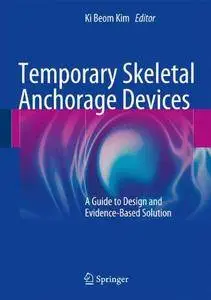 Temporary Skeletal Anchorage Devices: A Guide to Design and Evidence-Based Solution [Repost]