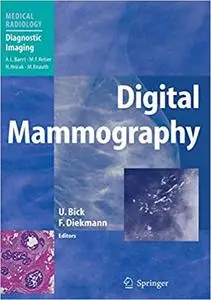Digital Mammography