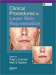 Clinical Procedures in Laser Skin Rejuvenation (Repost)