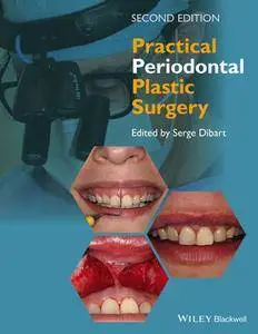 Practical Periodontal Plastic Surgery, 2nd Edition