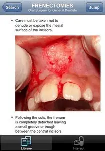 Lexi-DENTAL COMPLETE v1.0