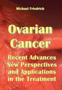 "Ovarian Cancer: Recent Advances, New Perspectives and Applications in the Treatment" ed. by Michael Friedrich