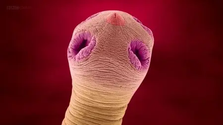 BBC - Infested: Living with Parasites (2014)