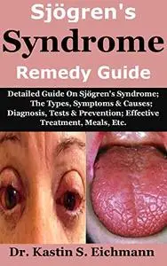 Sjögren's Syndrome Remedy Guide