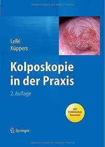 Kolposkopie in der Praxis (Repost)