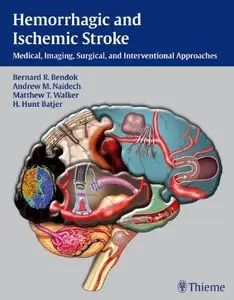Hemorrhagic and Ischemic Stroke: Medical, Imaging, Surgical and Interventional Approaches (repost)