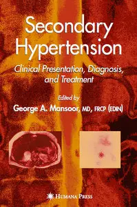 Secondary Hypertension: Clinical Presentation, Diagnosis, and Treatment (repost)