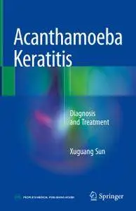 Acanthamoeba Keratitis: Diagnosis and Treatment