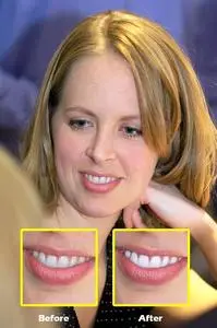 Image Trends PearlyWhites 1.01 for Photoshop
