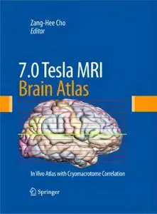 7.0 Tesla MRI Brain Atlas: In Vivo Atlas with Cryomacrotome Correlation (repost)