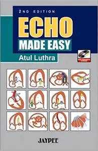 ECHO Made Easy (2nd Edition)