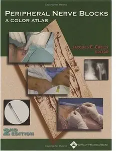 Peripheral Nerve Blocks: A Color Atlas (2nd edition)
