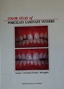 Color Atlas of Porcelain Laminate Veneers