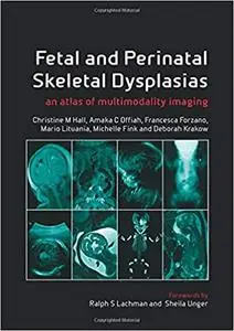 Fetal and Perinatal Skeletal Dysplasias: an Atlas of Multimodality Imaging