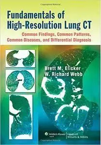 Fundamentals of High-resolution Lung CT