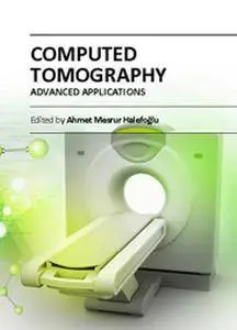 "Computed Tomography: Advanced Applications" ed. by Ahmet Mesrur Halefogl