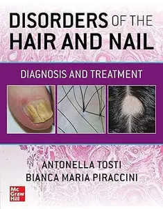 Disorders of the Hair and Nail: Diagnosis and Treatment