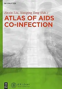 Atlas of AIDS Co-infection