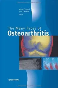 The Many Faces of Osteoarthritis (Repost)