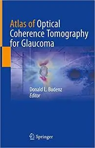 Atlas of Optical Coherence Tomography for Glaucoma