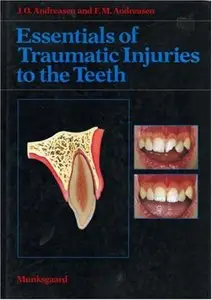 Essentials of Traumatic Injuries to the Teeth (Repost)