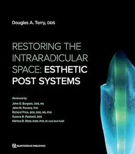 Restoring the Intraradicular Space: Esthetic Post Systems (Repost)