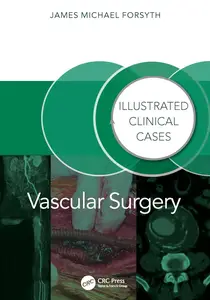 Vascular Surgery:: Illustrated Clinical Cases