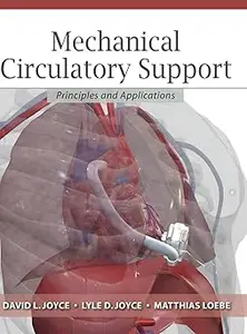 Mechanical Circulatory Support: Principles and Applications