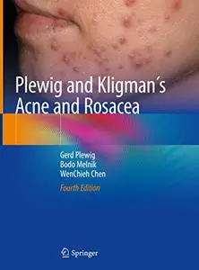 Plewig and Kligman´s Acne and Rosacea (Repost)