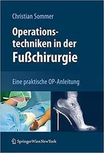 Operationstechniken in der Fußchirurgie: Eine praktische OP-Anleitung (German Edition)