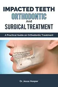 Impacted Teeth Orthodontic and Surgical Treatment: A Practical Guide on Orthodontic and Surgical Treatment