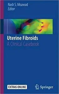 Uterine Fibroids: A Clinical Casebook