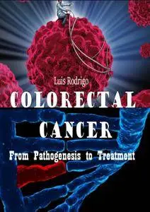 "Colorectal Cancer: From Pathogenesis to Treatment" ed. by Luis Rodrigo
