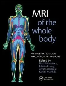 MRI of the Whole Body: An Illustrated Guide for Common Pathologies: An Illustrated Guide to Common Pathologies