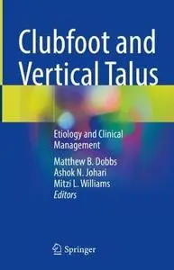 Clubfoot and Vertical Talus: Etiology and Clinical Management