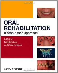 Oral Rehabilitation: A Case-Based Approach (Repost)