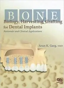 Bone Biology, Harvesting, & Grafting For Dental Implants: Rationale and Clinical Applications