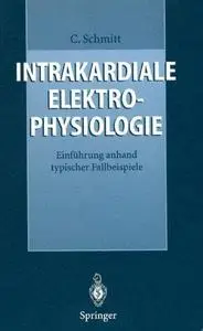 Intrakardiale Elektrophysiologie: Einführung anhand typischer Fallbeispiele