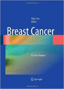 Breast Cancer: A Lobar Disease (Repost)