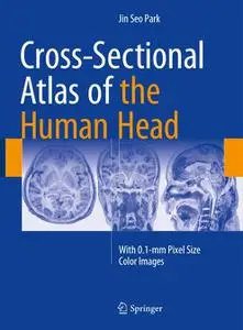 Cross-Sectional Atlas of the Human Head: With 0.1-mm pixel size color images (Repost)