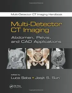 Multi-Detector CT Imaging: Abdomen, Pelvis, and CAD Applications (Repost)