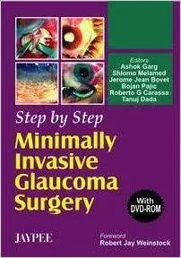 Step by Step Minimally invasive Glaucoma Surgery